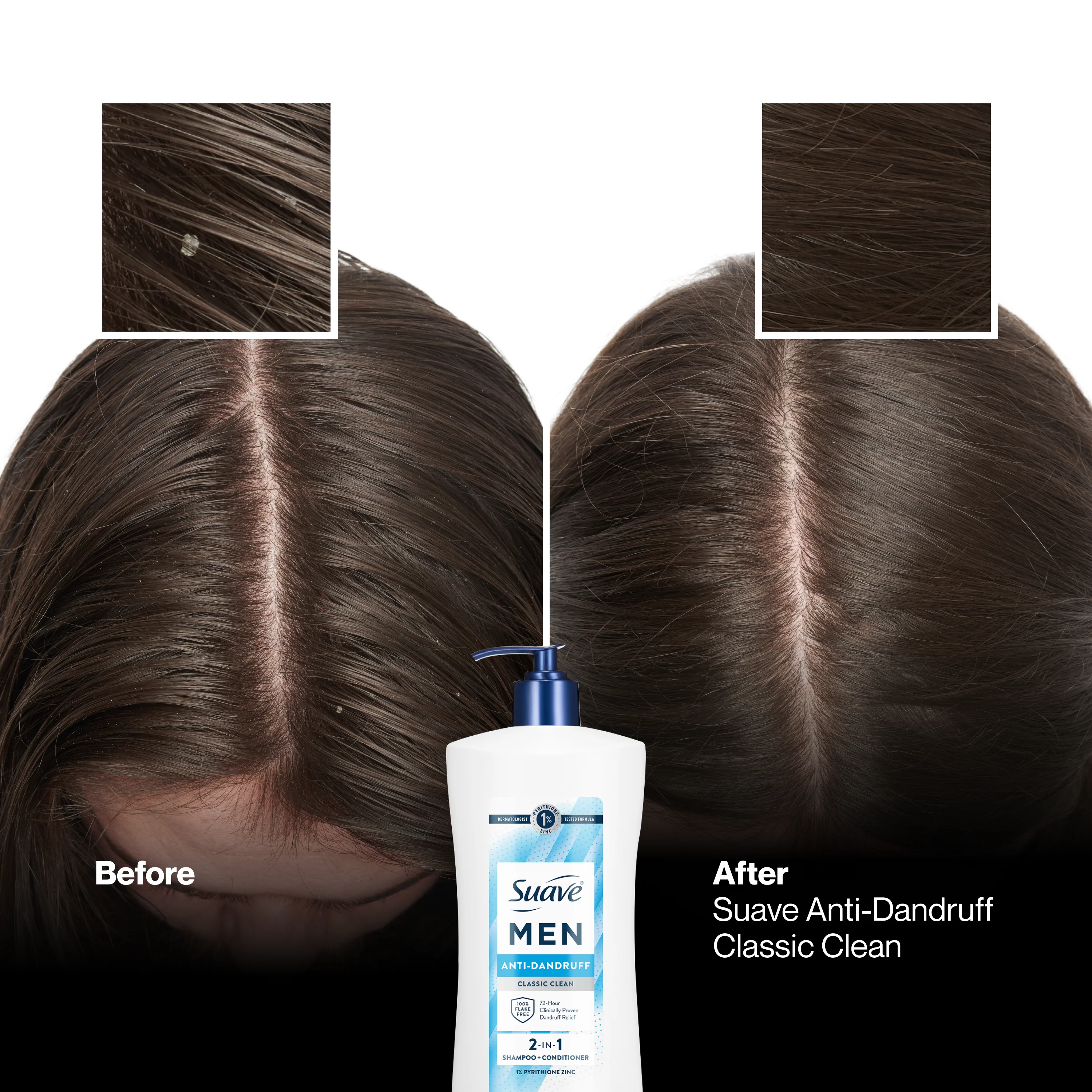 Classic Clean Men's 2-in1 Anti Dandruff Shampoo & Conditioner - Image 7